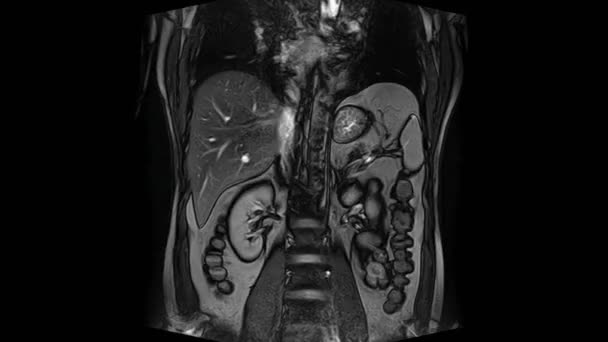 CT sken břicha. Počítačová tomografie gastrointestinálního traktu, jater a ledvin.