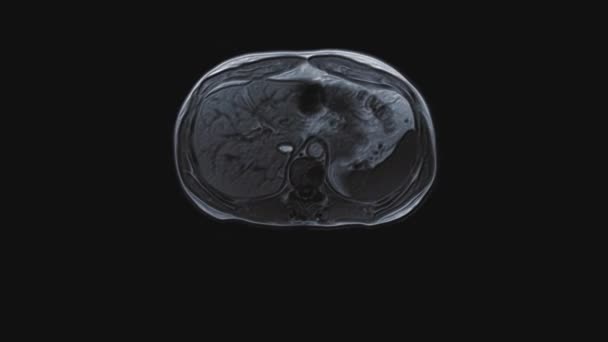Objętościowa tomografia kolorystyczna brzucha. Tomografia komputerowa przewodu pokarmowego, wątroby i nerek — Wideo stockowe