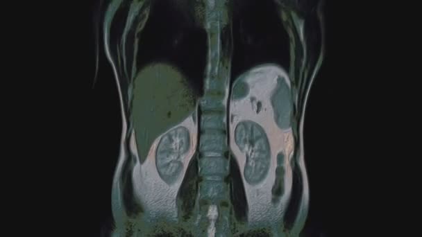 Rozsáhlý mnohobarevný CT sken břicha. Počítačová tomografie gastrointestinálního traktu, jater a ledvin — Stock video