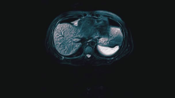 Voluminöse Farb Aufnahme Des Bauchraums Computertomographie Des Magen Darm Traktes — Stockvideo