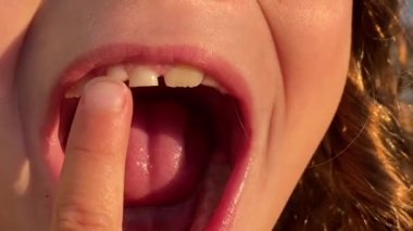 Genç kız parmağıyla düşmek üzere olan gevşek bebek dişini ileri geri hareket ettiriyor.