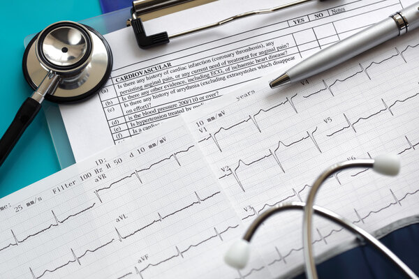 Cardiogram and stethoscope — Stock Photo, Image