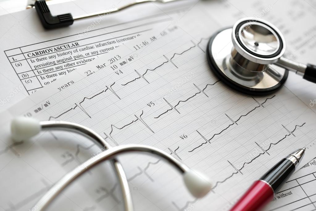 Cardiogram and stethoscope