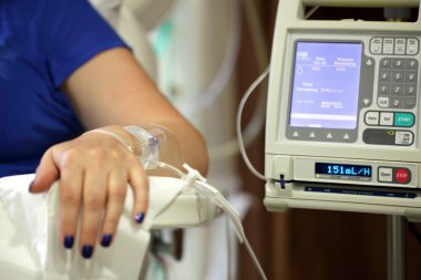 intravenöz IV damla