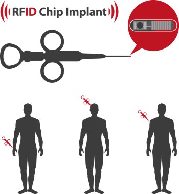 implante edilebilir RFID etiketi simgesi