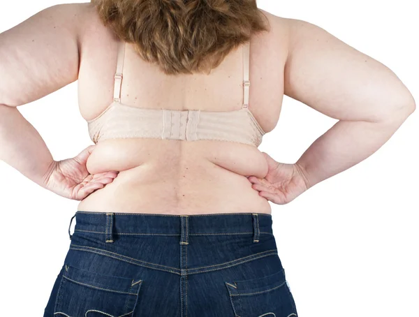 Sırtüstü ve fazla kilolu