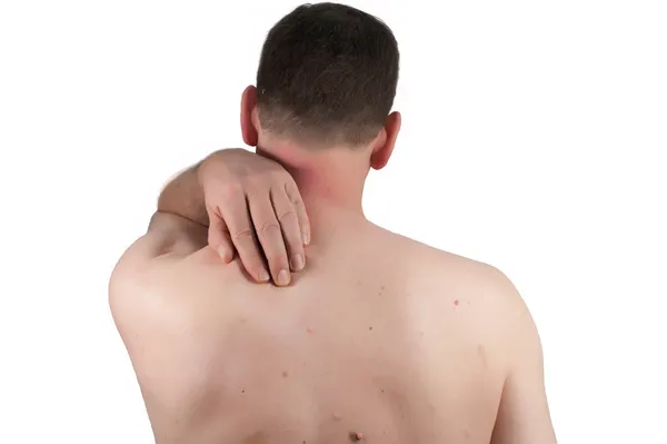 Liver spot or nack pain — Stock Photo, Image