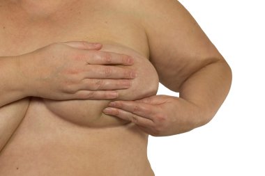 kadın meme 6.Mastopati veya kanser incelenmesi