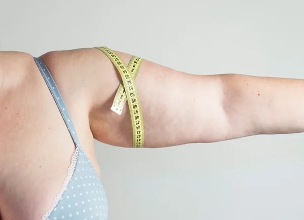 Mujer mostrando su celulitis — Foto de Stock