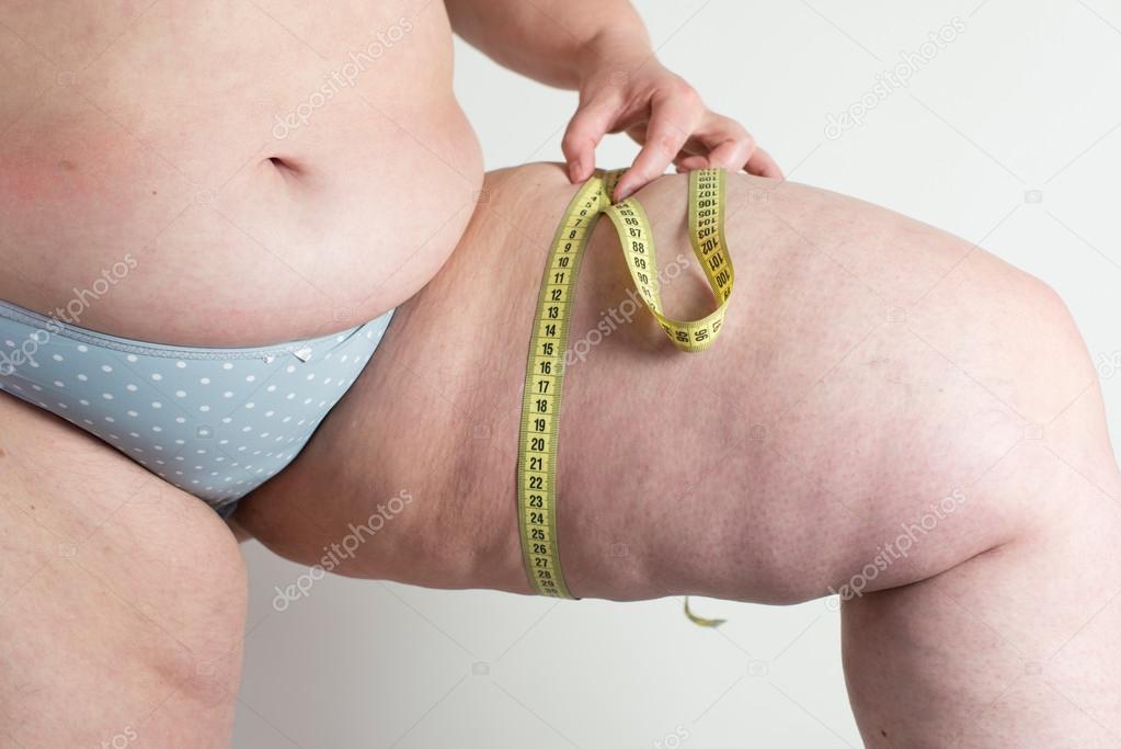 Woman showing her cellulite
