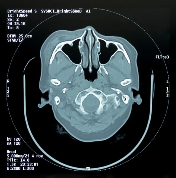 Head Scan — Stock Photo, Image