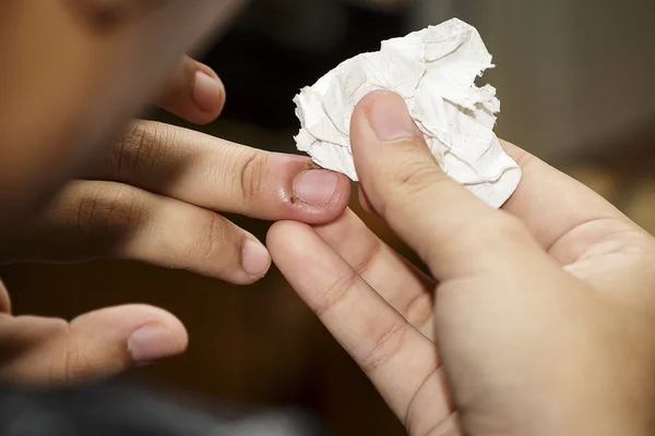 yaralar, ısırıkları çivi