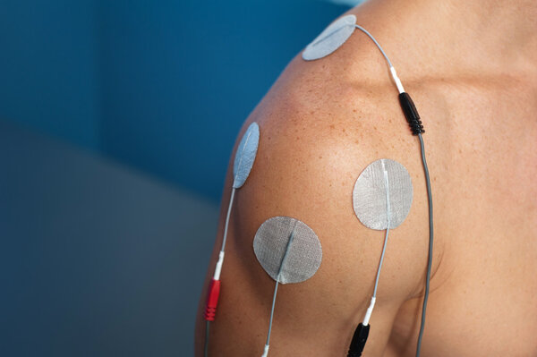 Shoulder Electrical Stimulation
