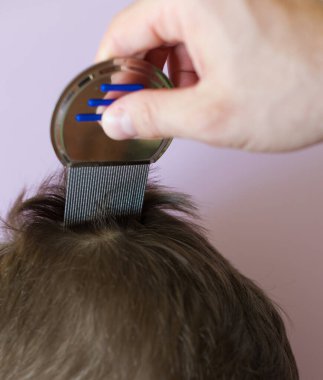 Lice comb and brunette hair on a violet background with copy space. Man using nit comb on childs hair