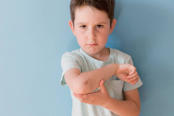 Caucasian boy with grazed hand on a blue background with copy space