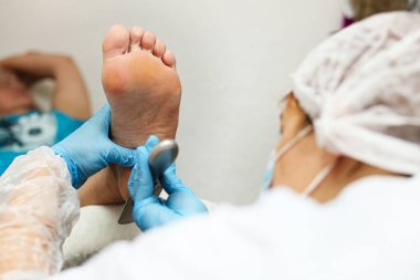 Topuğu pedikürle soyan doktor, ayak derisini tedavi eder.