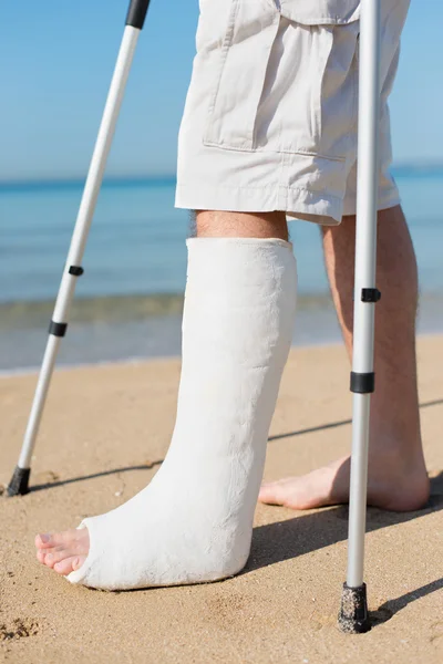 Homem com gesso na perna em uma praia — Fotografia de Stock