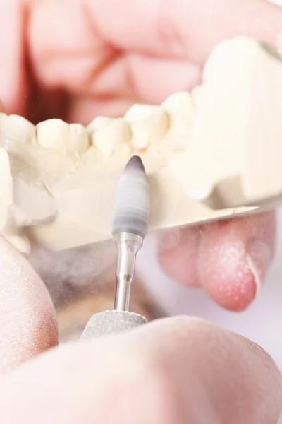 Dentist molding prosthetic teeth — Stock Photo, Image