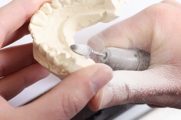 假肢牙技术员模具的牙齿 — 图库照片
