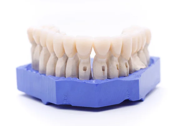 Prosthetic teeth on white background — Stock Photo, Image