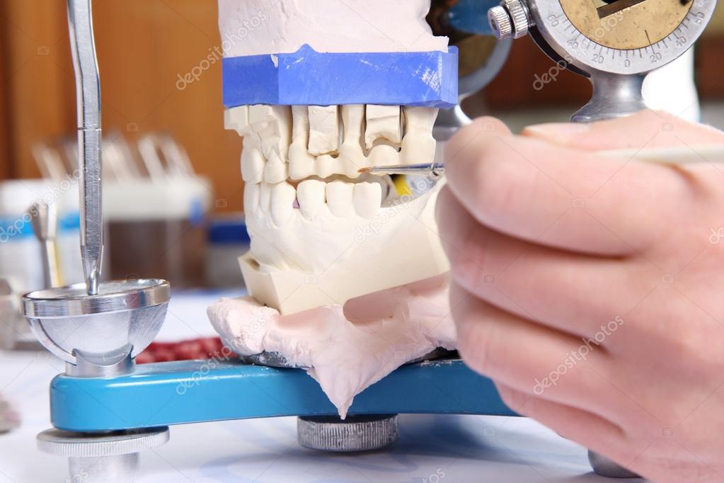 Dentist molding prosthetic teeth Stock Photo by ©racorn 26229303