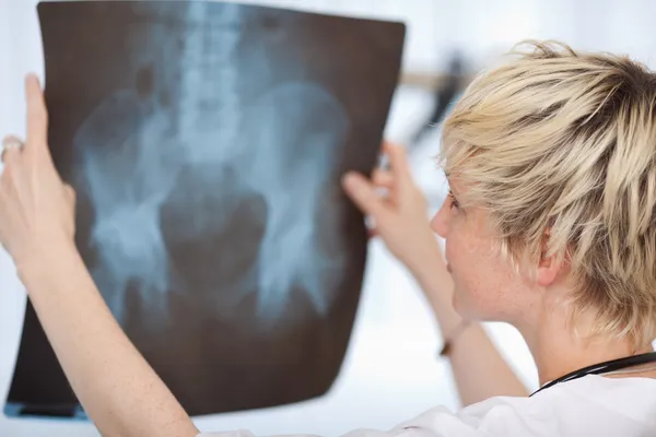 Médico femenino mirando el informe de rayos X — Foto de Stock