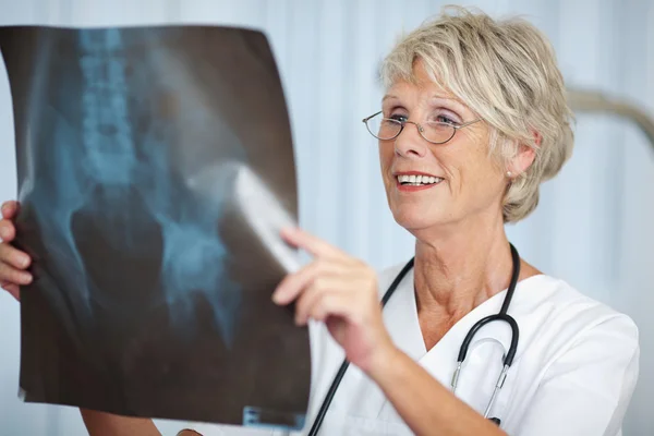 Senior vrouwelijke arts kijken naar hip xray verslag — Stockfoto