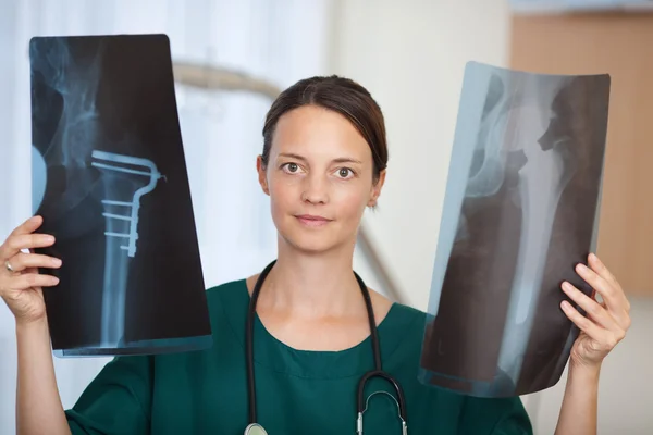 Женщина-врач, держащая рентгеновские отчеты в больнице — стоковое фото