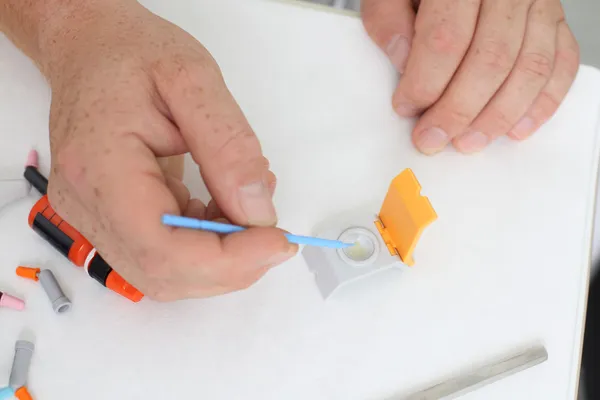 Dentista em clínica preparando enchimento — Fotografia de Stock