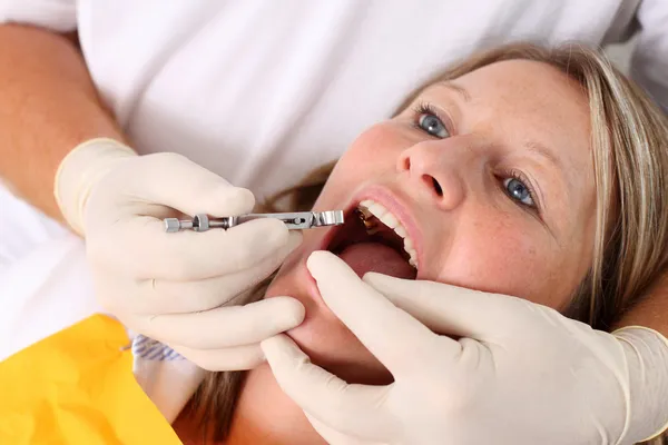 Anesthesia at the dentist — Stock Photo, Image