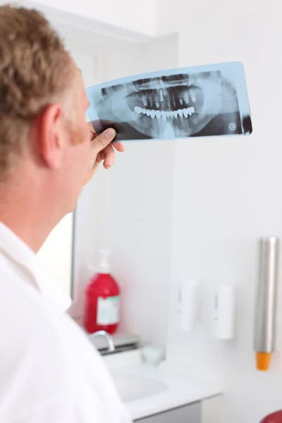 Dentalt röntgenbilden — Stockfoto