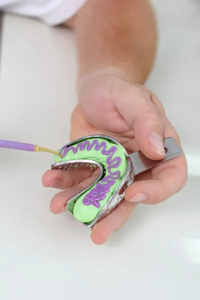 Dentist's Hand Preparing Teeth Impression Tool — Stock Photo, Image