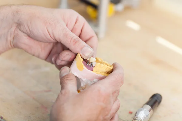 Técnico Dental Trabalhando em Laboratório — Fotografia de Stock