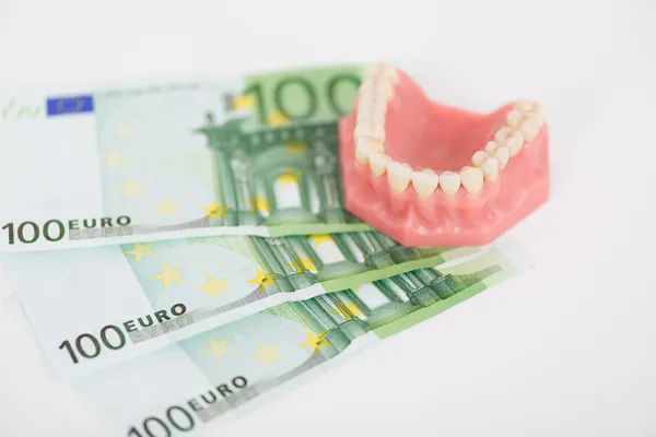 Dentaduras com notas de 100 euros — Fotografia de Stock