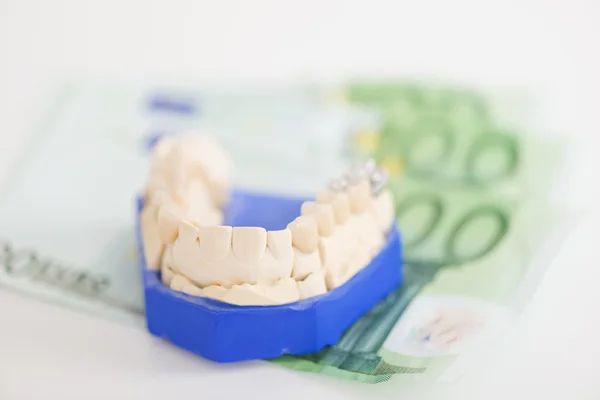 Denti artificiali su carta moneta in officina — Foto Stock