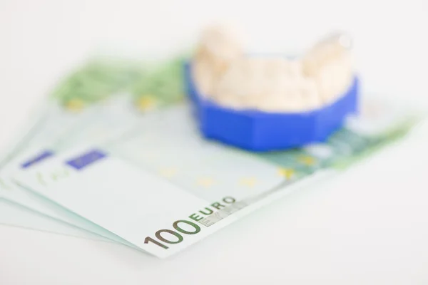 Banconote da 100 euro con impianto dentale — Foto Stock