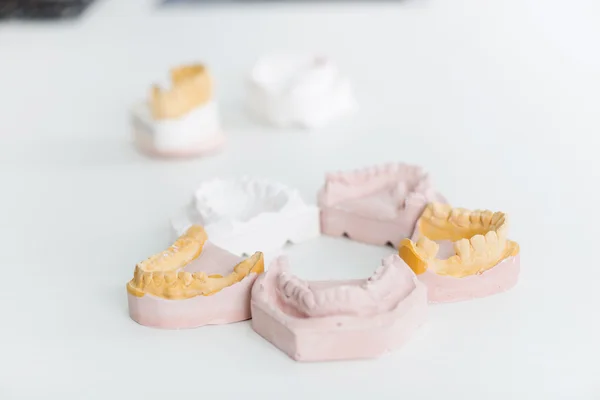 Impressões dentárias em laboratório — Fotografia de Stock