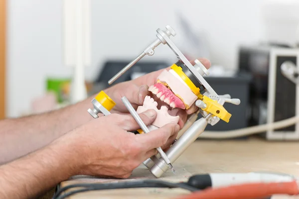 Technicus handen werken met Articulator In tandheelkundige laboratorium — Stockfoto