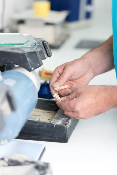 Die Hände des Zahntechnikers arbeiten an künstlichen Zähnen — Stockfoto