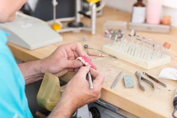 Die Hände des Zahntechnikers arbeiten am Zahnmodell — Stockfoto