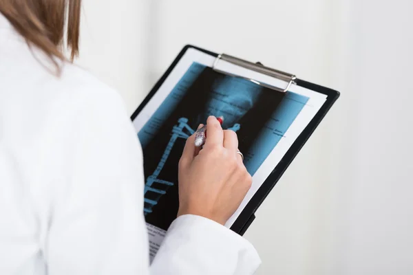 Radiologiste regardant une radiographie — Photo