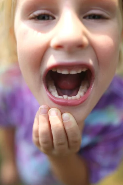 Pequeno Bonito Criança Anos Está Mostrando Hir Primeiro Dente Torto — Fotografia de Stock