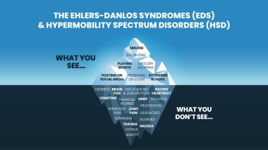Ehlers-Danlos Sendromları (EDS) ve Hipermobilite Spektrum Bozukluğu (HDS) modelinin yüzey semptomu fizyolojik analiz ve tanı analizi için mutlu ve normal davranışlar görebilmektedir. 