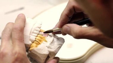 implantlar diş Laboratuvarı.