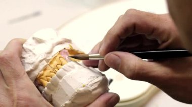 implantlar diş Laboratuvarı.