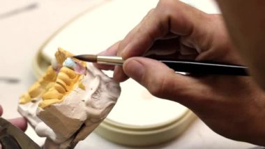 implantlar diş Laboratuvarı.