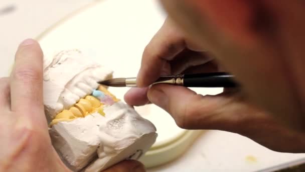 Tandheelkundige implantaten laboratorium. — Stockvideo