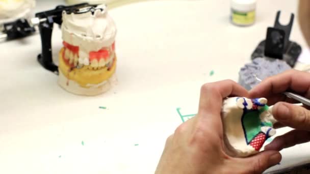 Зубні імплантати лабораторні . — стокове відео