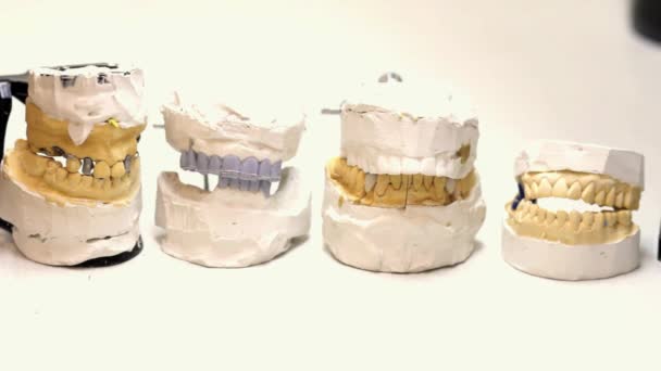 Técnico dentário local de trabalho. Moldes de mandíbulas . — Vídeo de Stock