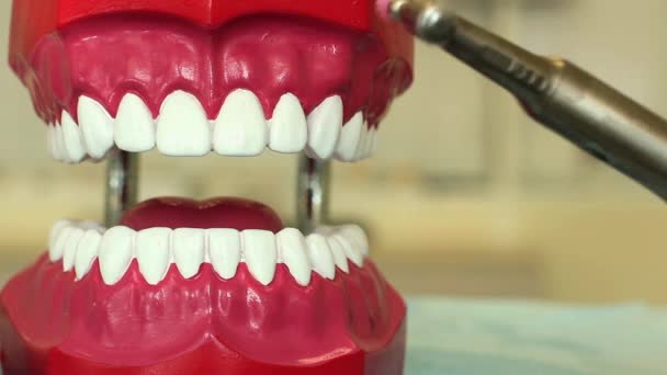 Dental treatment on the example of the toy jaw — Stock Video